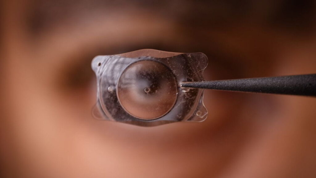 Close-up van een kunstlens voor een lensimplantatie.